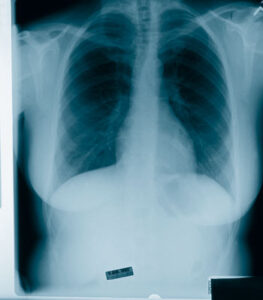 Asthma Tips From the Garden Image